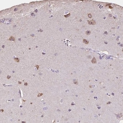 PNMA2 Antibody, Novus Biologicals 0.1mL; Unlabeled:Antibodies, Polyclonal
