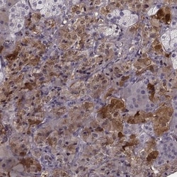 PNMT Antibody, Novus Biologicals 0.1mL; Unlabeled:Antibodies, Polyclonal