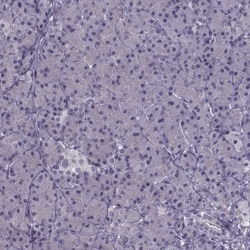 PNMT Antibody, Novus Biologicals 0.1mL; Unlabeled:Antibodies, Polyclonal