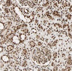 PNPLA6 Antibody, Novus Biologicals 25 &mu;L; Unlabeled:Antibodies, Polyclonal