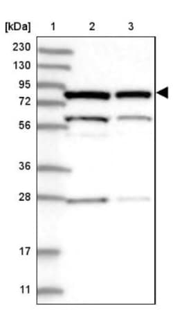 PNPT1 Antibody, Novus Biologicals 0.1mL; Unlabeled:Antibodies, Polyclonal