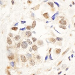 PNUTS/PPP1R10 Antibody, Novus Biologicals 0.1mL; Unlabeled:Antibodies,