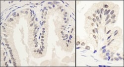 PNUTS/PPP1R10 Antibody, Novus Biologicals 0.1mL; Unlabeled:Antibodies,
