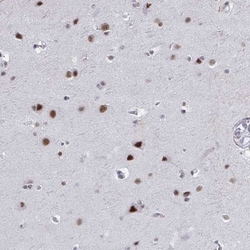 PNUTS/PPP1R10 Antibody, Novus Biologicals:Antibodies:Primary Antibodies