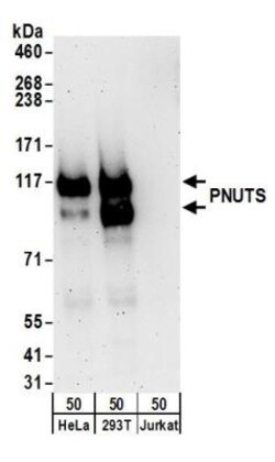 PNUTS/PPP1R10 Antibody, Novus Biologicals 0.1mL; Unlabeled:Antibodies,
