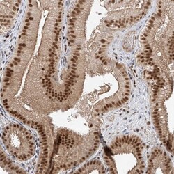 POGK Antibody, Novus Biologicals:Antibodies:Primary Antibodies