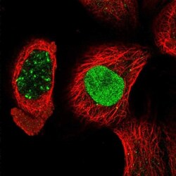 POLDIP1 Antibody, Novus Biologicals 25 &mu;L, Unlabeled:Antibodies, Polyclonal