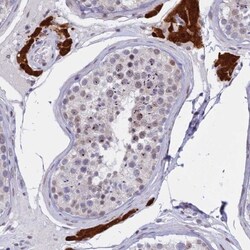 POLDIP1 Antibody, Novus Biologicals 25 &mu;L, Unlabeled:Antibodies, Polyclonal