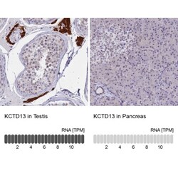 POLDIP1 Antibody, Novus Biologicals 25 &mu;L, Unlabeled:Antibodies, Polyclonal