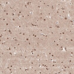 POLDIP1 Antibody, Novus Biologicals 25 &mu;L, Unlabeled:Antibodies, Polyclonal