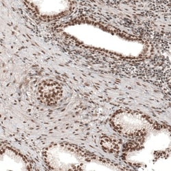 POLDIP1 Antibody, Novus Biologicals 25 &mu;L, Unlabeled:Antibodies, Polyclonal