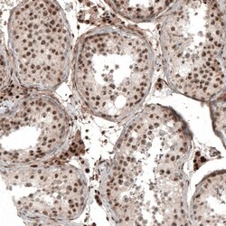 POLDIP1 Antibody, Novus Biologicals 25 &mu;L, Unlabeled:Antibodies, Polyclonal