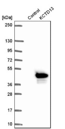 POLDIP1 Antibody, Novus Biologicals 25 &mu;L, Unlabeled:Antibodies, Polyclonal