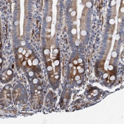 POLG2 Antibody, Novus Biologicals 0.1mL; Unlabeled:Antibodies, Polyclonal
