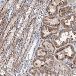 POLG2 Antibody, Novus Biologicals 0.1mL; Unlabeled:Antibodies, Polyclonal