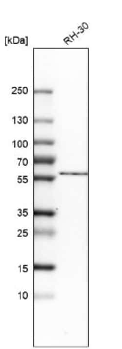 POLG2 Antibody, Novus Biologicals 0.1mL; Unlabeled:Antibodies, Polyclonal
