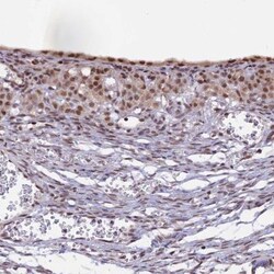 POLR2C Antibody, Novus Biologicals 0.1mL; Unlabeled:Antibodies, Polyclonal