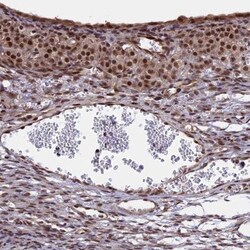 POLR2C Antibody, Novus Biologicals 0.1mL; Unlabeled:Antibodies, Polyclonal