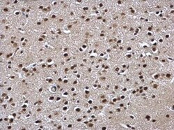 POLR2C Antibody, Novus Biologicals 0.1mL; Unlabeled:Antibodies, Polyclonal