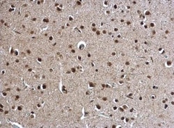 POLR2C Antibody, Novus Biologicals 0.1mL; Unlabeled:Antibodies, Polyclonal