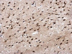 POLR2G Antibody, Novus Biologicals 0.1mg; Unlabeled:Antibodies, Polyclonal