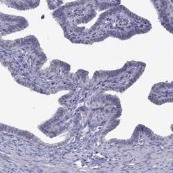 POM121L12 Antibody, Novus Biologicals:Antibodies:Primary Antibodies