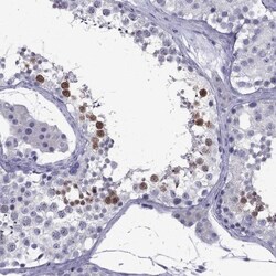POM121L12 Antibody, Novus Biologicals:Antibodies:Primary Antibodies