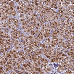 POMGNT1 Antibody, Novus Biologicals 0.1mL; Unlabeled:Antibodies, Polyclonal