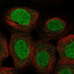 POM121 Antibody, Novus Biologicals 0.1mL; Unlabeled:Antibodies, Polyclonal