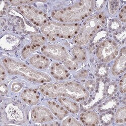 POP4 Antibody, Novus Biologicals 0.1mL; Unlabeled:Antibodies, Polyclonal