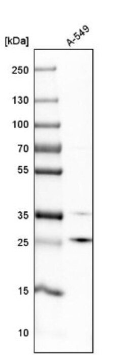 POP4 Antibody, Novus Biologicals 0.1mL; Unlabeled:Antibodies, Polyclonal