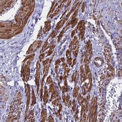 POP7 Antibody, Novus Biologicals:Antibodies:Primary Antibodies