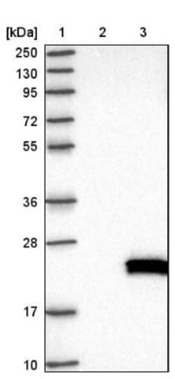 POP7 Antibody, Novus Biologicals 25 &mu;L, Unconjugated:Antibodies, Polyclonal