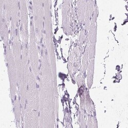 POPDC2 Antibody, Novus Biologicals 0.1 mL | Buy Online | Novus Biologicals | Fisher Scientific
