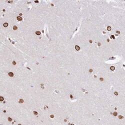 POU6F1 Antibody, Novus Biologicals 25 &mu;L, Unlabeled:Antibodies, Polyclonal