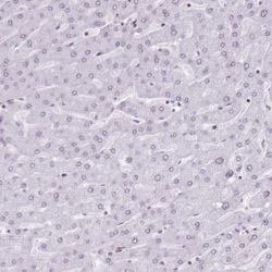 POU6F1 Antibody, Novus Biologicals 25 &mu;L, Unlabeled:Antibodies, Polyclonal