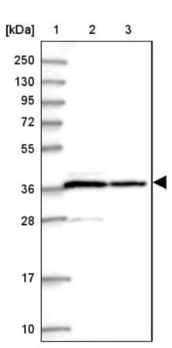 PP1 alpha/PPP1A Antibody, Novus Biologicals 0.1mL; Unlabeled:Antibodies,