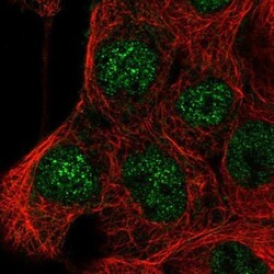 PP14/Glycodelin Antibody, Novus Biologicals:Antibodies:Primary Antibodies