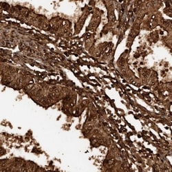 PP14/Glycodelin Antibody, Novus Biologicals 25 &mu;L; Unlabeled:Antibodies,