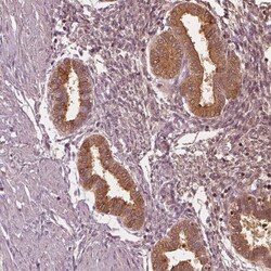 PP14/Glycodelin Antibody, Novus Biologicals 25 &mu;L; Unlabeled:Antibodies,