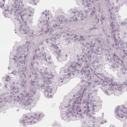 PP14/Glycodelin Antibody, Novus Biologicals:Antibodies:Primary Antibodies