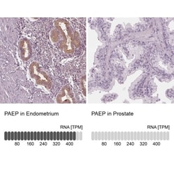 PP14/Glycodelin Antibody, Novus Biologicals:Antibodies:Primary Antibodies
