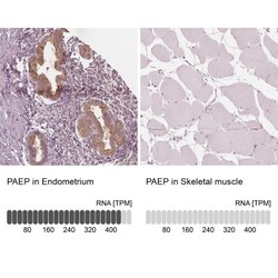 PP14/Glycodelin Antibody, Novus Biologicals:Antibodies:Primary Antibodies