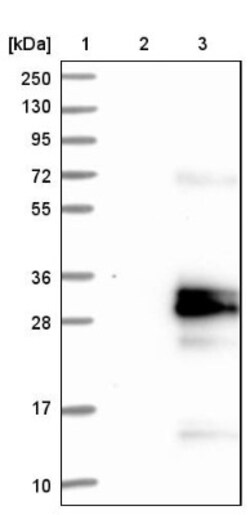 PP14/Glycodelin Antibody, Novus Biologicals 25 &mu;L; Unlabeled:Antibodies,