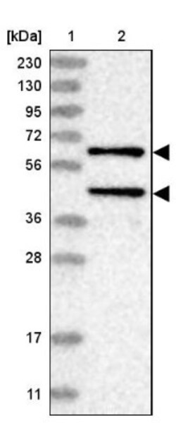 PP2C alpha/PPM1A Antibody, Novus Biologicals 25ul | Buy Online | Novus Biologicals | Fisher Scientific