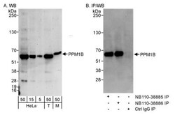 PP2C beta/PPM1B Antibody, Novus Biologicals 0.1mL; Unlabeled:Antibodies,