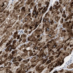 PP2C epsilon/PPM1L Antibody, Novus Biologicals:Antibodies:Primary Antibodies