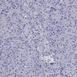 PP2C gamma/PPM1G Antibody, Novus Biologicals:Antibodies:Primary Antibodies