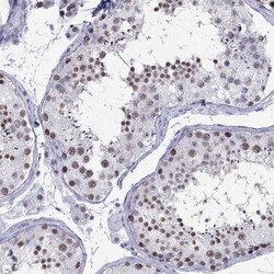 PP2C gamma/PPM1G Antibody, Novus Biologicals:Antibodies:Primary Antibodies