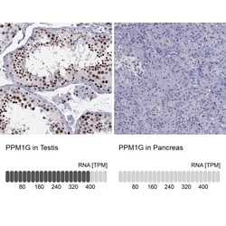 PP2C gamma/PPM1G Antibody, Novus Biologicals 0.1mL; Unlabeled:Antibodies,